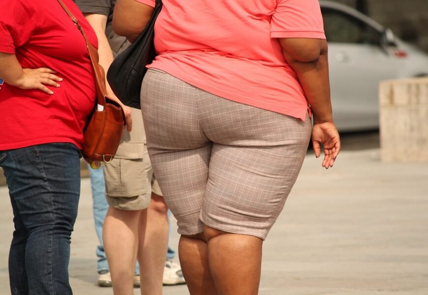 World’s most obese man dies after weight-loss surgery